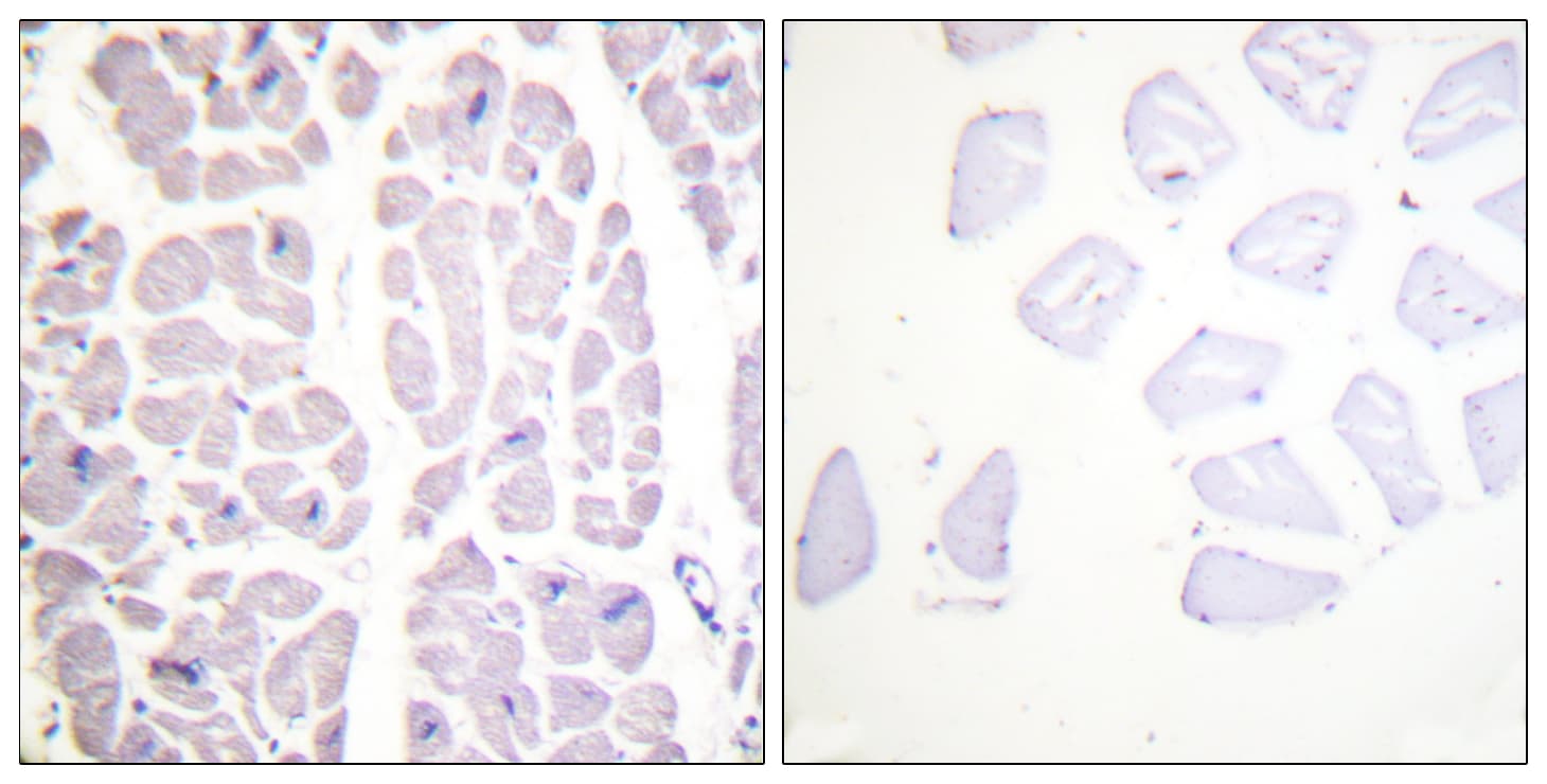 Polyclonal Rabbit anti-Human IKK Alpha+Beta Antibody (phospho-Ser180/Ser181, IHC, WB)