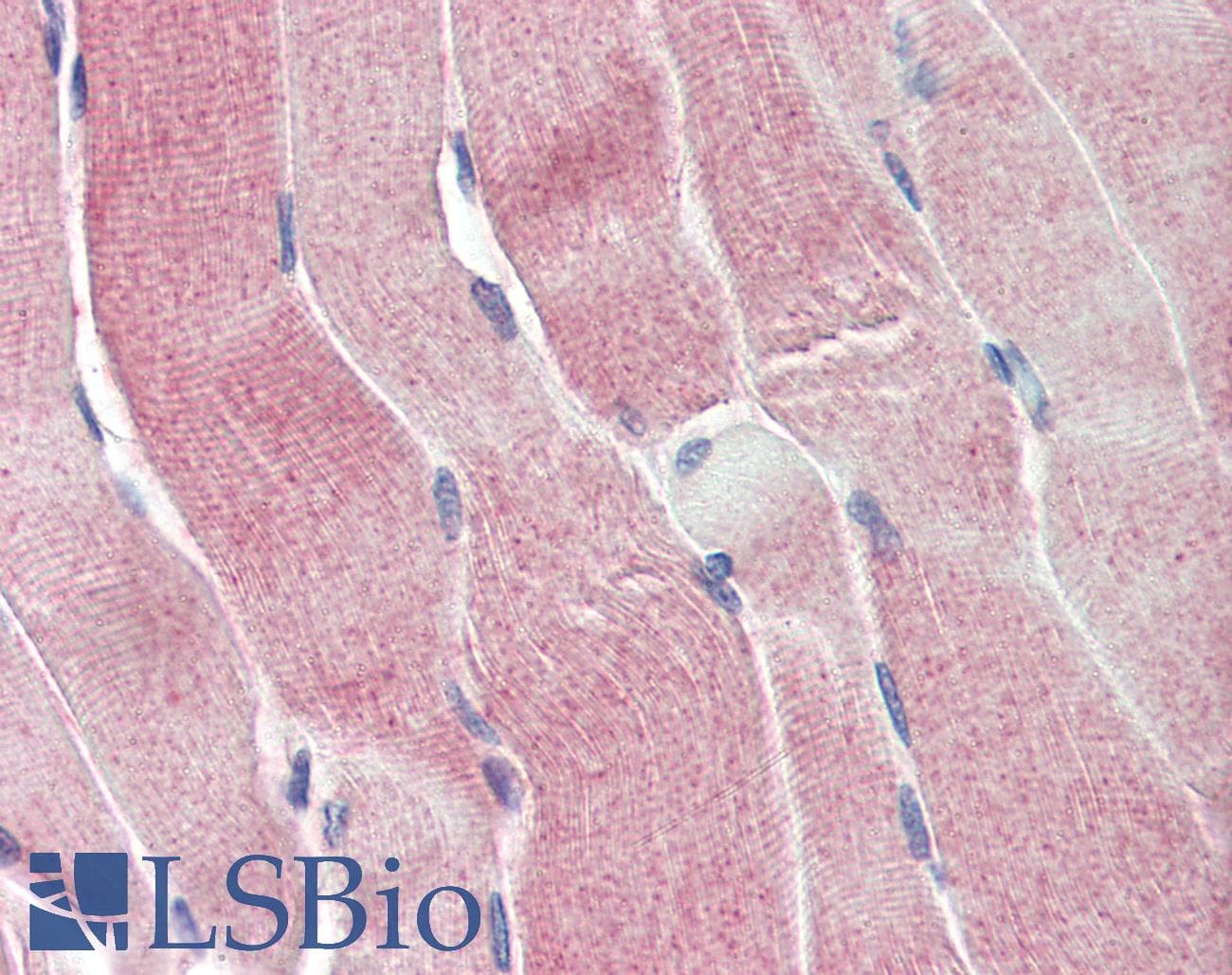 IHC-plus™ Polyclonal Goat anti-Human SIRT4 / Sirtuin 4 Antibody (aa302-314, IHC, WB)
