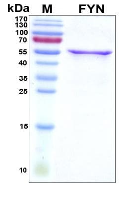 Human SYN / FYN Protein (Recombinant His, N-Terminal)
