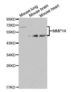 Polyclonal Rabbit anti-Human MMP14 Antibody (IHC, WB)