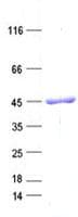 Human MRPS31 Protein (Recombinant His, N-Terminal)