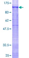 Human GYS1 / Glycogen Synthase Protein (Recombinant GST)