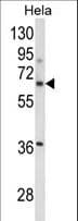 Polyclonal Rabbit anti-Human ITGBL1 Antibody (aa334-360, IHC, WB)
