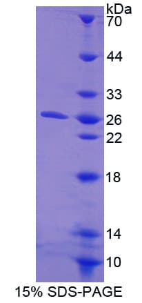 Human CTHRC1 Protein (Recombinant His-T7)