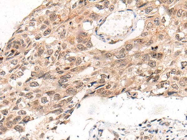KNOP1 / C16orf88 Antibody