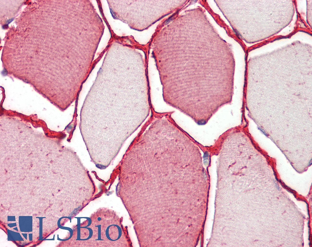 IHC-plus™ Polyclonal Goat anti-Human TRIM72 / MG53 Antibody (aa61-70, IHC, WB)