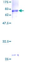 Human PCGF2 / MEL-18 Protein (Recombinant GST)