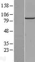 Human PIBF1 / PIBF Protein (Over-Expression Lysate Myc-DDK (Flag))