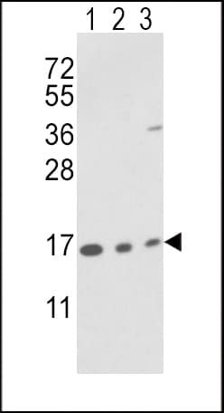 PPIA / Cyclophilin A Antibody (aa8-37)