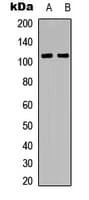 Polyclonal Rabbit anti-Human IL10RA Antibody (C-Terminus, IF, WB)