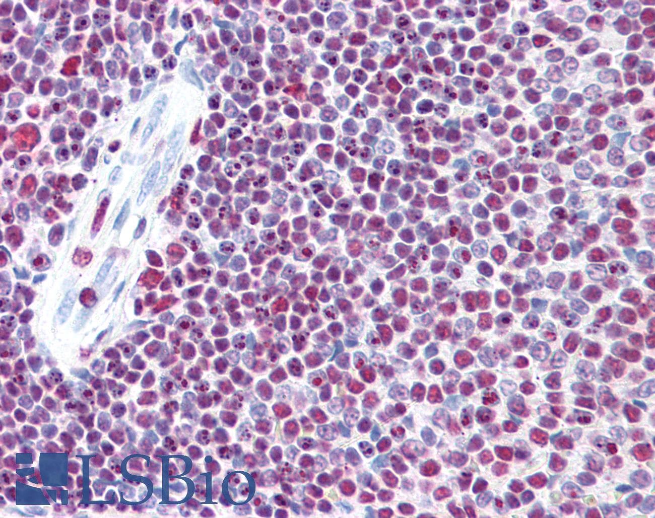 IHC-plus™ EP300 / p300 Antibody (clone 1B1)