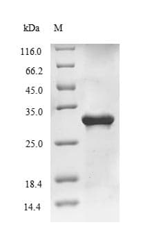 Influenza A Virus Hemagglutinin Protein (Recombinant 10His, N-terminus + Myc, C-terminus)