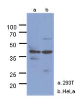 NAGK Antibody (clone AT4D12)