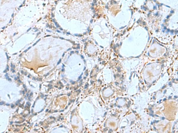 KIAA1434 protein Antibody