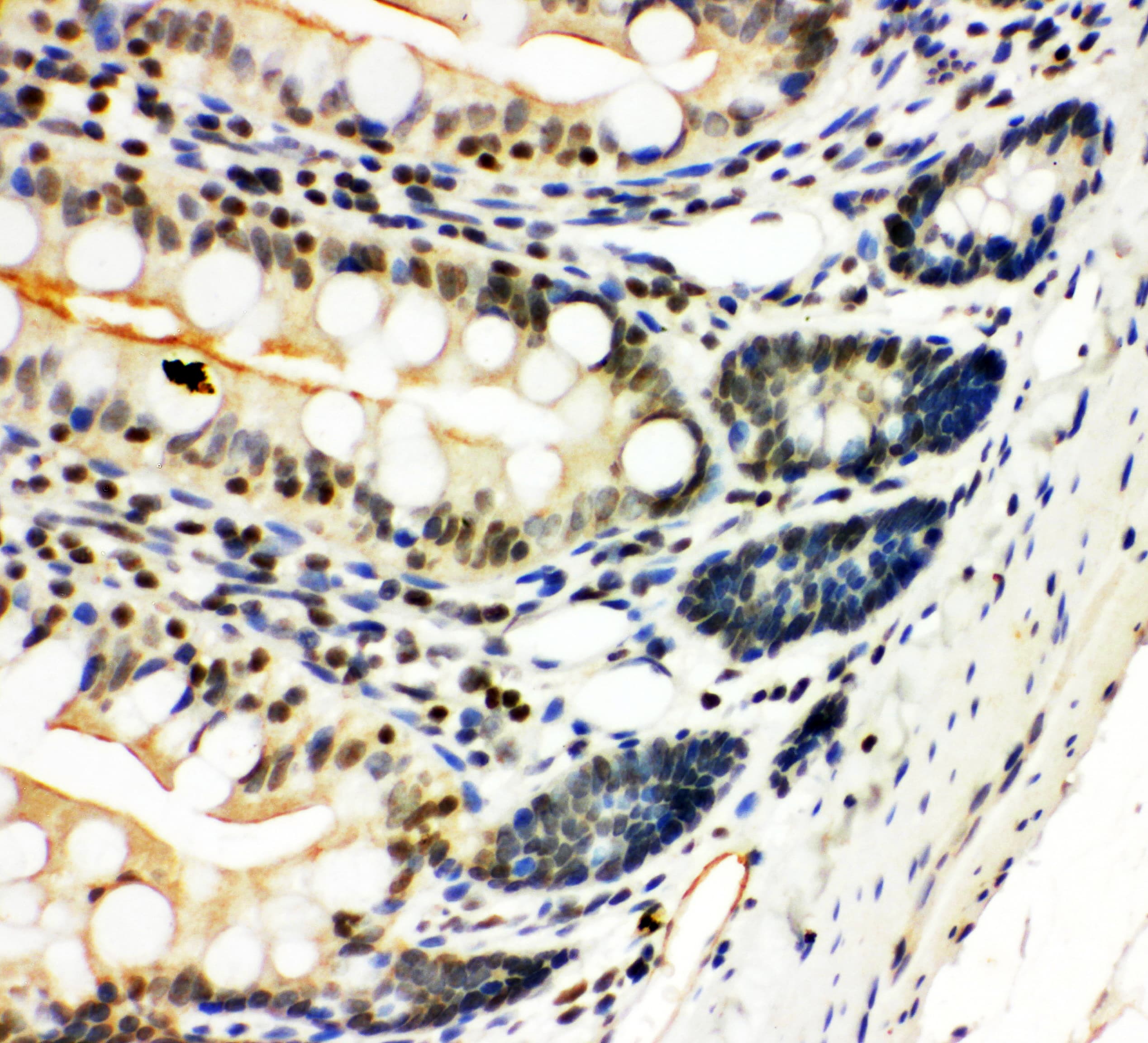 NFKB2 Antibody (aa5-21)