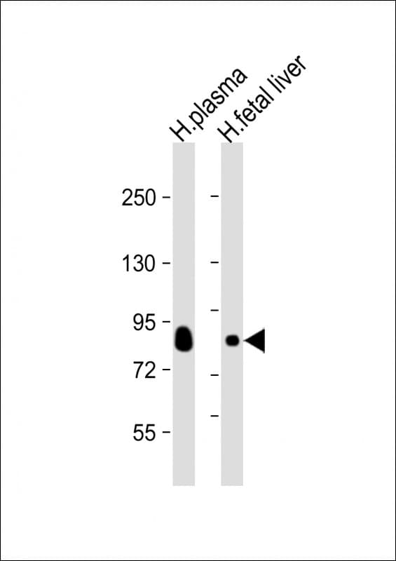 TF / Transferrin Antibody