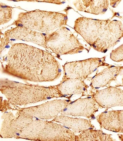 MME / CD10 Antibody (aa492-525)