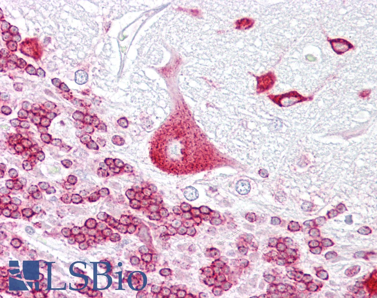 Polyclonal Rabbit anti-Human PURA / Pur-Alpha Antibody (aa108-157, IHC, WB)