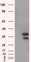 DAPK2 / DAP Kinase 2 Antibody (clone OTI1C8)