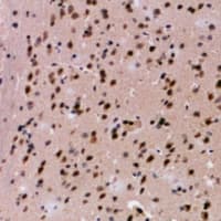 Polyclonal Rabbit anti-Human HBA2 / Hemoglobin Alpha 2 Antibody (IHC, WB)