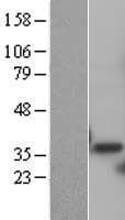 Human PSMD14 Protein (Over-Expression Lysate Myc-DDK (Flag))
