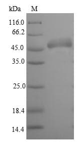 Escherichia coli gltI Protein (Recombinant 6His-SUMO, N-terminus)