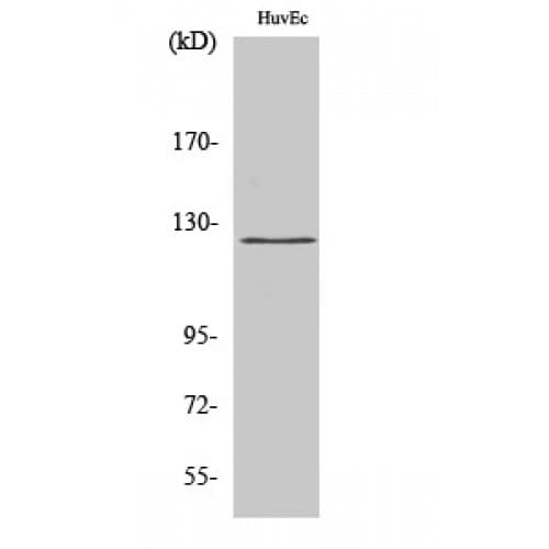 UBE3C Antibody (Internal)