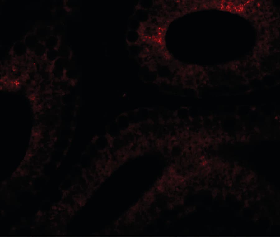 SPATA6 / SRF-1 Antibody