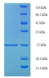 Human RETN / Resistin Protein (Recombinant His-SUMO)