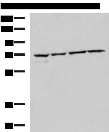 CBFA2T2 / MTGR1 Antibody