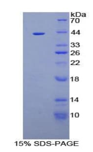 Human AQP2 / Aquaporin 2 Protein (Recombinant His-GST)