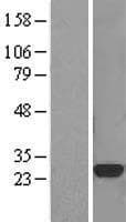CTHRC1 Protein (Over-Expression Lysate Myc-DDK (Flag))
