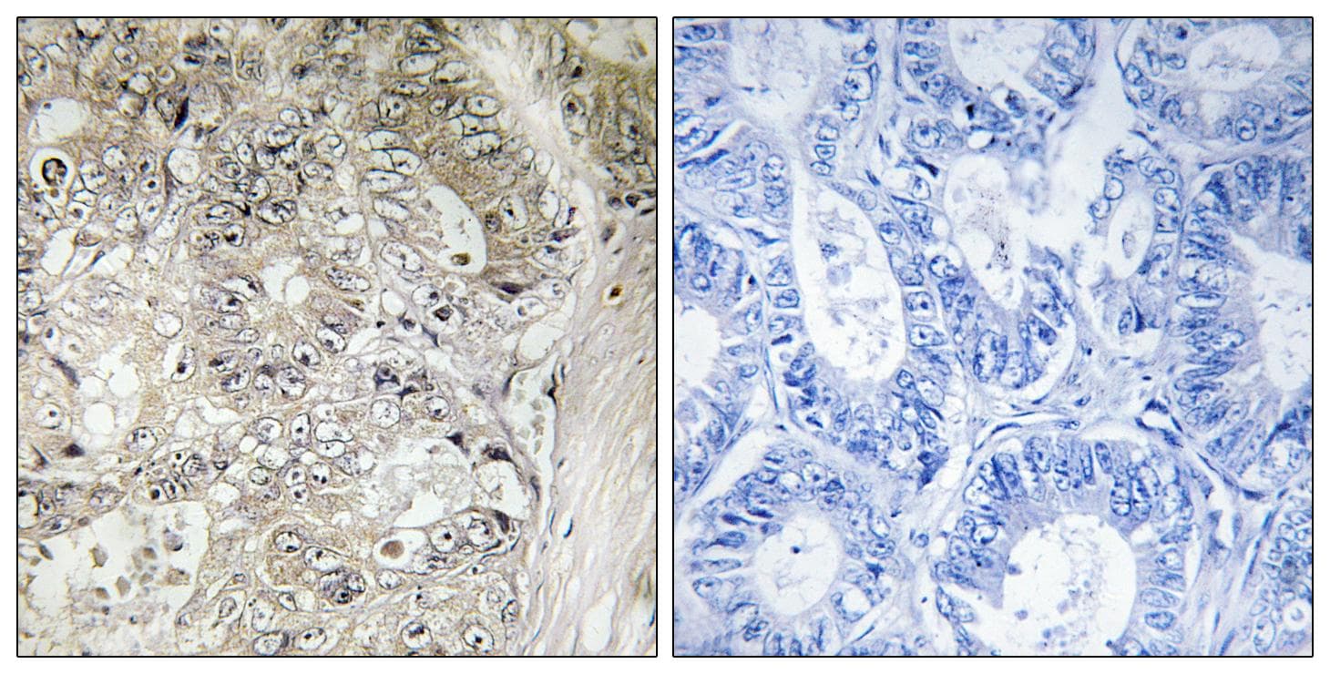 CST1 / Cystatin SN Antibody
