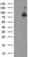 ACSS2 / ACAS2 Antibody (clone OTI3G3)