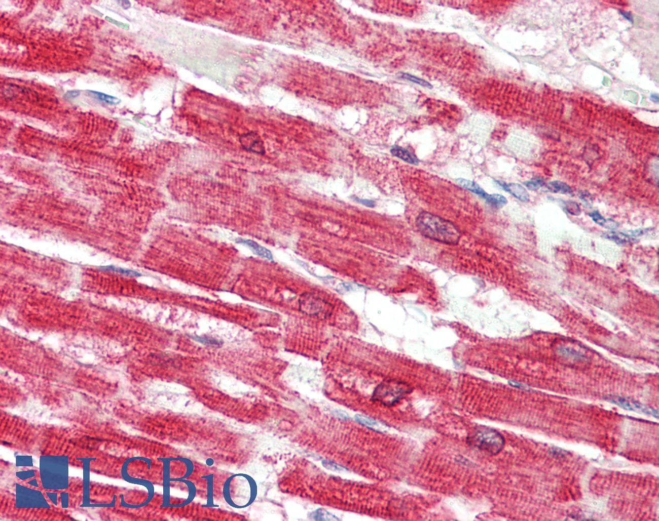 IHC-plus™ ATP2A2 / SERCA2 Antibody (aa658-671)