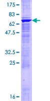 Human MAP2K4 / MKK4 Protein (Recombinant GST)