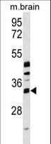 METTL6 Antibody (aa168-195)