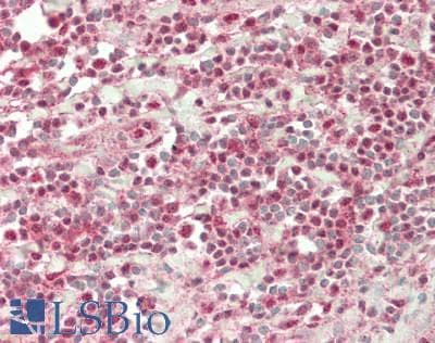 IHC-plus™ EIF4A3 Antibody