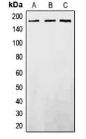 Polyclonal Rabbit anti-Human EGFR Antibody (C-Terminus, IHC, WB)