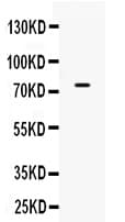 ACSL3 Antibody