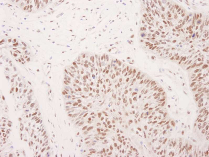 Polyclonal Rabbit anti-Human ASH2L / ASH2 Antibody (aa50-100, IHC, WB)