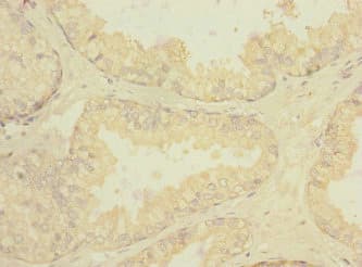 RGR Antibody