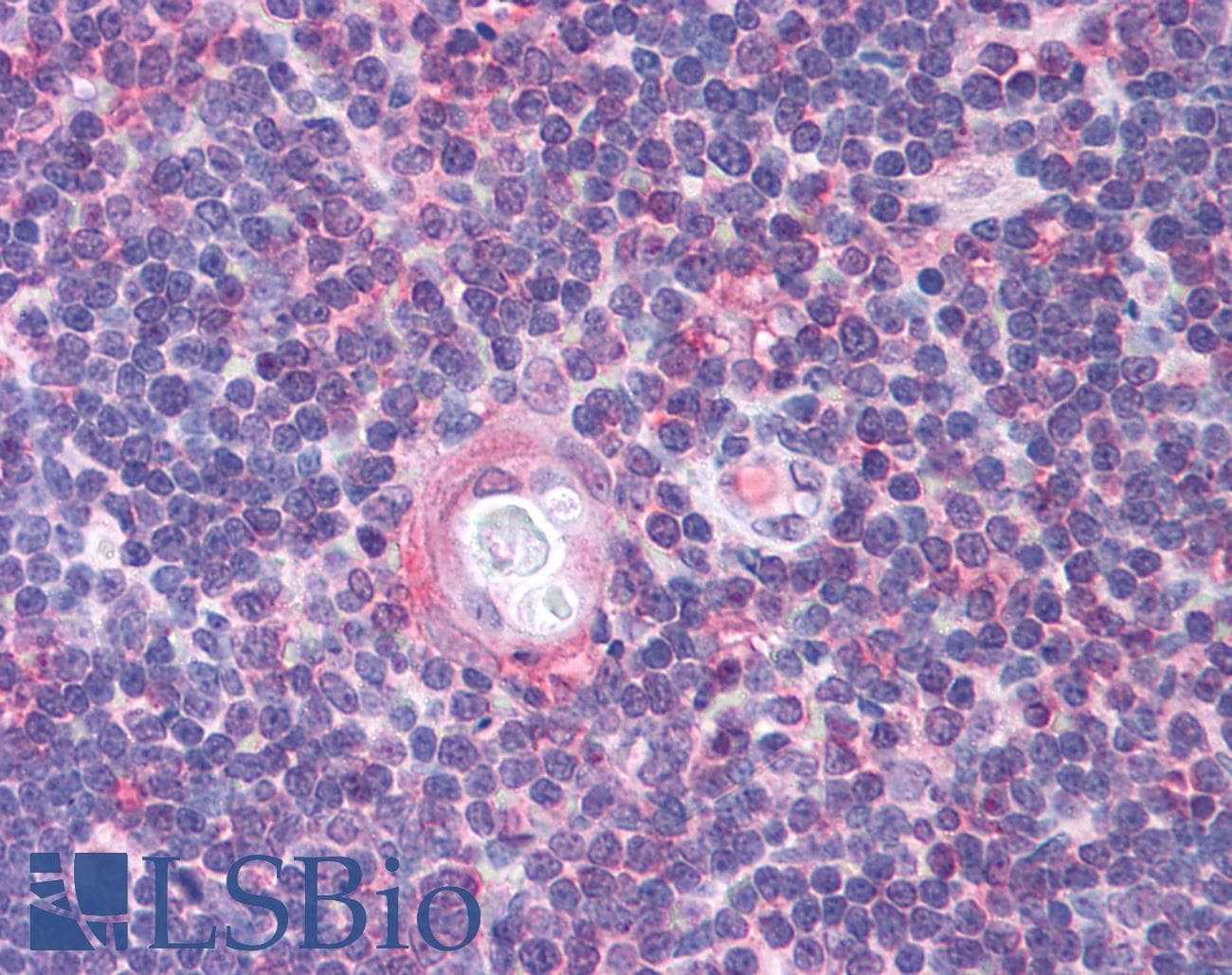 Polyclonal Rabbit anti-Human CDC25B Antibody (aa56-105, IHC, WB)