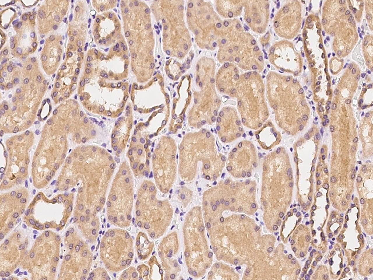 CEACAM21 Antibody