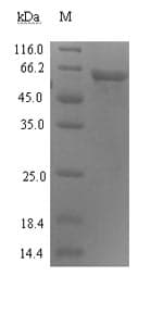 Human ADRM1 Protein (Recombinant 6His-SUMO, N-terminus)