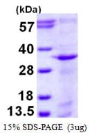 Human STX12 / Syntaxin 12 Protein (Recombinant His)