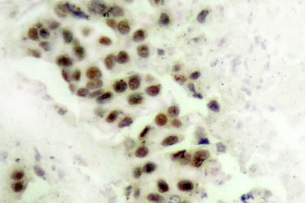 TP53 / p53 Antibody (phospho-Ser9)