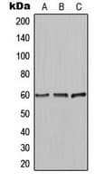 AKT1 + AKT2 + AKT3 Antibody (C-Terminus)