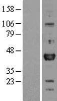 OTX1 Protein (Over-Expression Lysate Myc-DDK (Flag))
