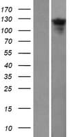 CFAP70 / TTC18 Protein (Over-Expression Lysate Myc-DDK (Flag))